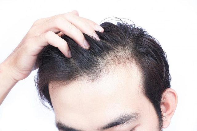 Hair_Fall_Treatment