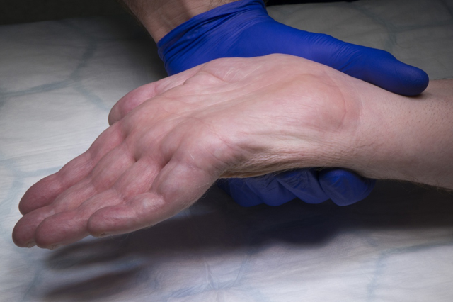 Nerve_Injuries_Tendon_Transfers