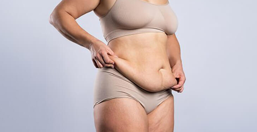 Body Contouring