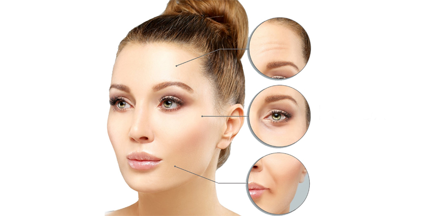 Botox and Facial Fillers