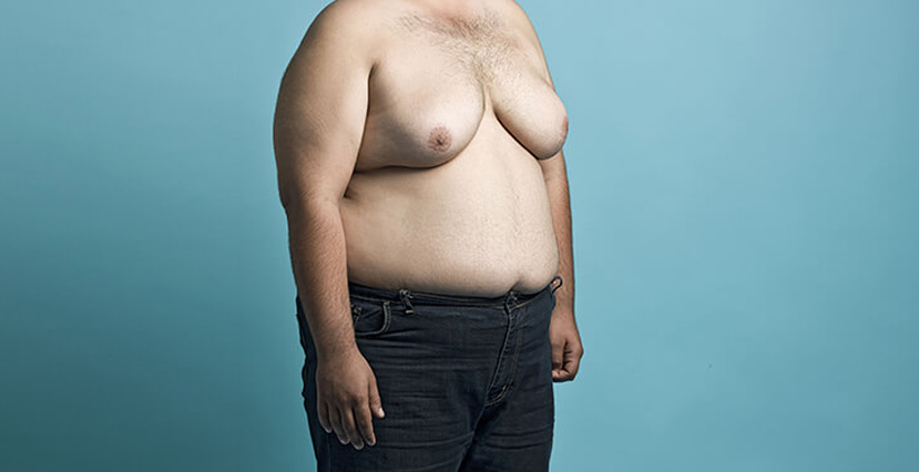 Male Breast Correction