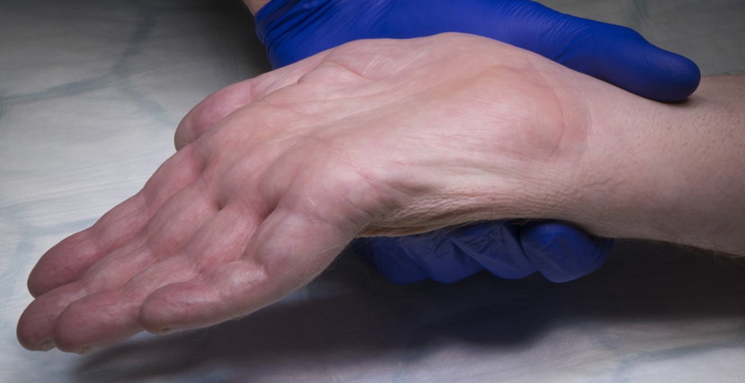 Nerve Injuries, Tendon Injuries & Tendon Transfers